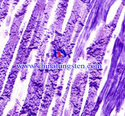 Phosphotungstic Acid Hematoxylin Dyeing Picture